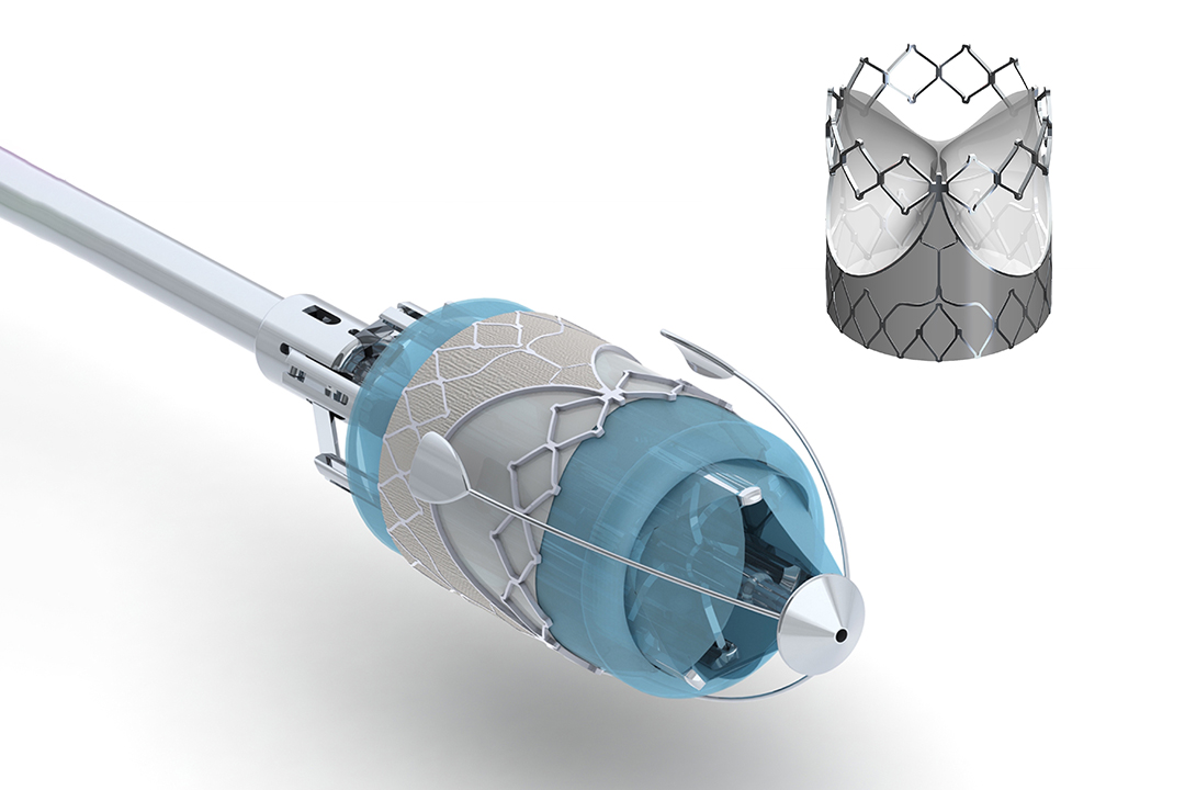 Strait Access Technologies TAVR (Transcatheter Aortic Valve Replacement)